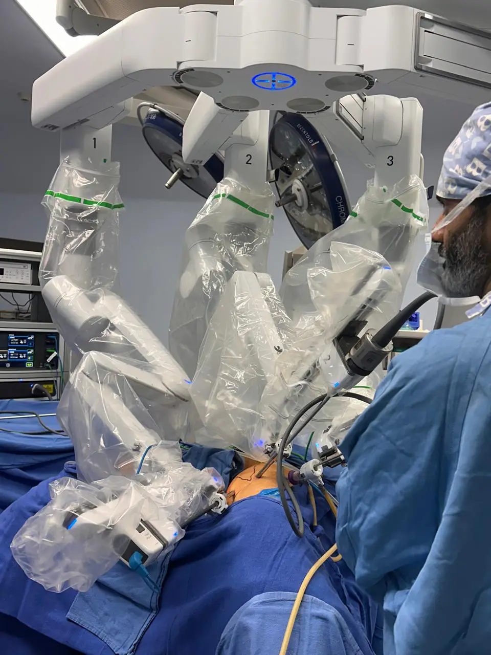 Robotic and Laparoscopic Uro-Onco Surgeon